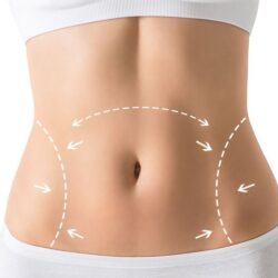 tummy-tuck-athens-ga-moore-center